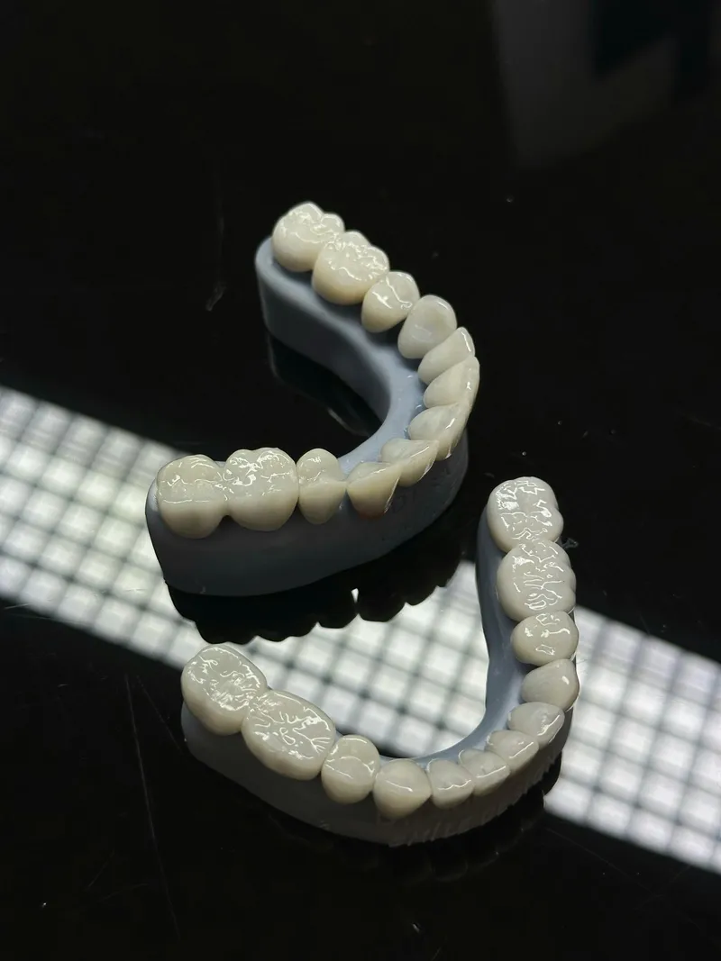 Dental implants