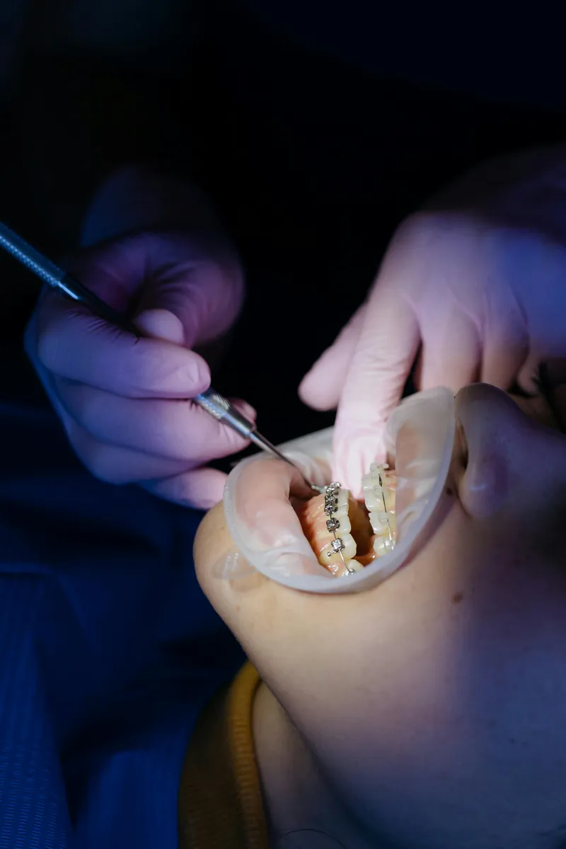 Orthodontic treatment