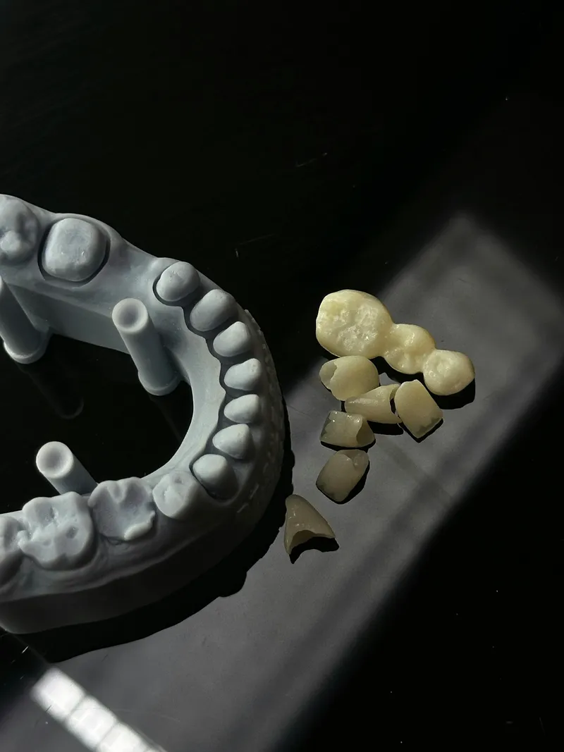 Prosthodontics