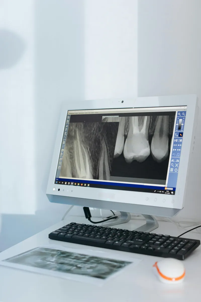 Panoramic X-rays
