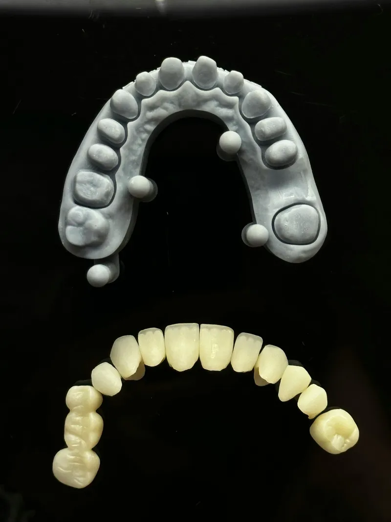 Prosthodontics under NHIF (KTLK) agreements