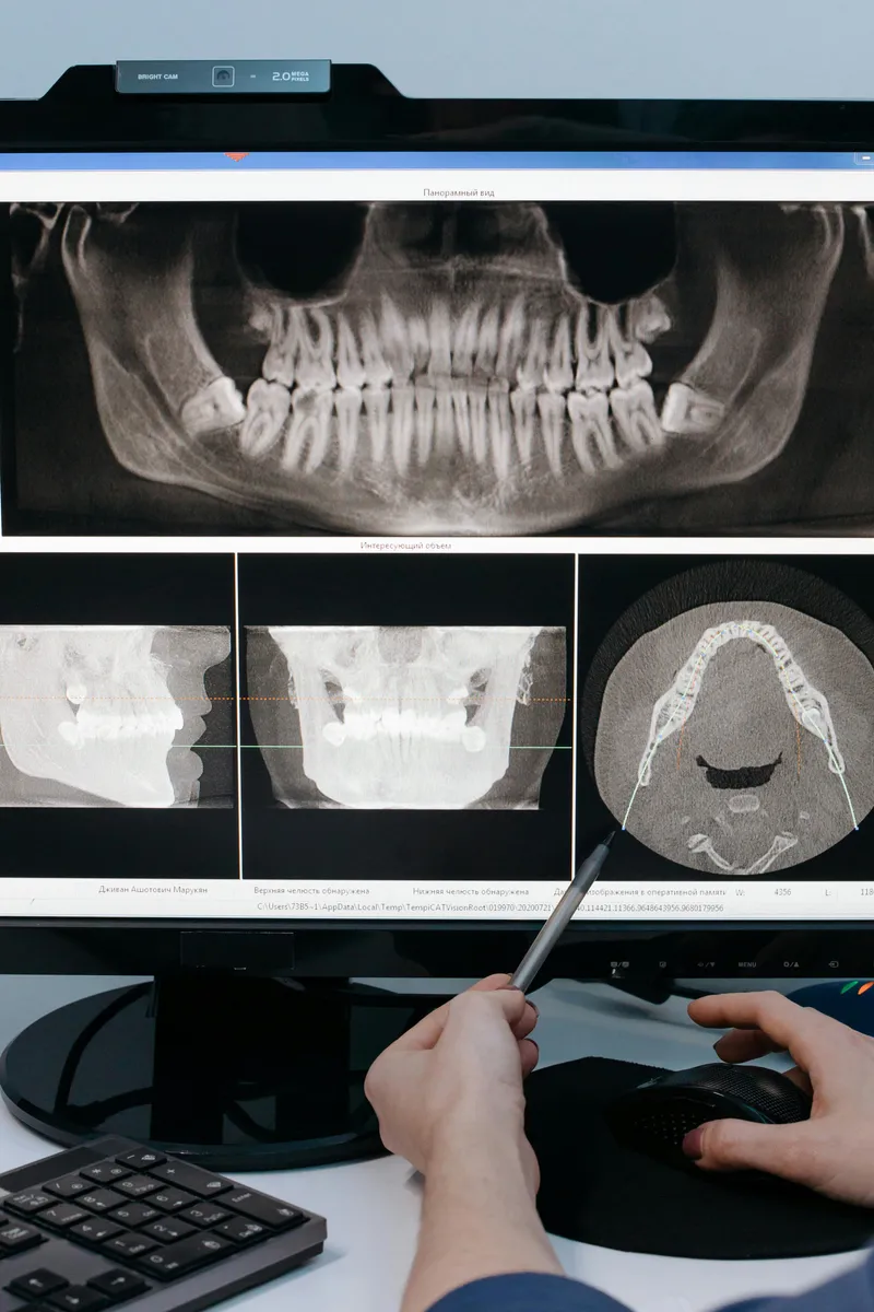 Digital radiography (RVG)